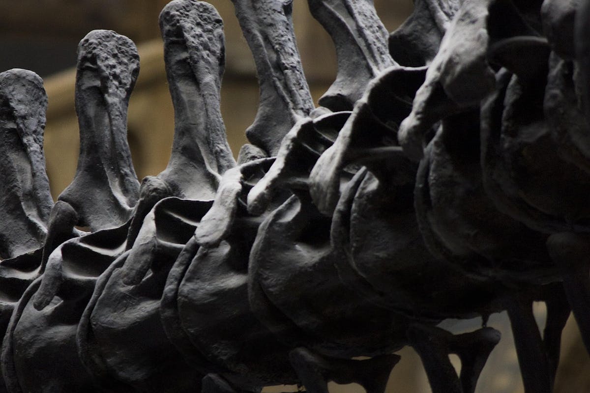 Osteopenia/porosis—What now?